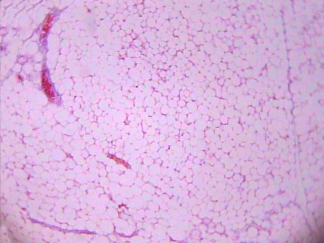 Reticular