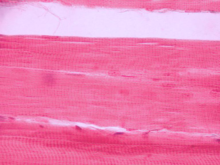 Muscle tissue /