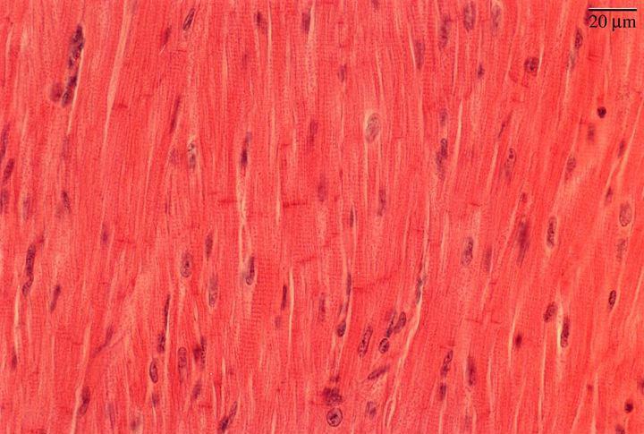 3. Cardiac muscle /