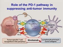 Nivolumab: New Standard of Care for Progressive Head and Neck Cancer After Platinum Therapy May 10, 2016 Nivolumab (Opdivo), an anti PD-1 (programmed cell death protein 1) checkpoint inhibitor,