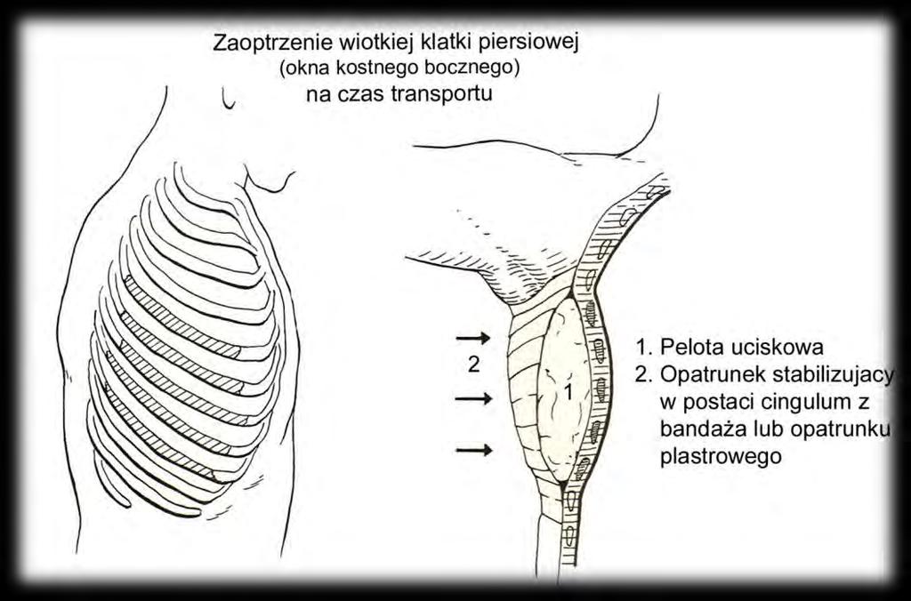 Stabilizacja odcinka