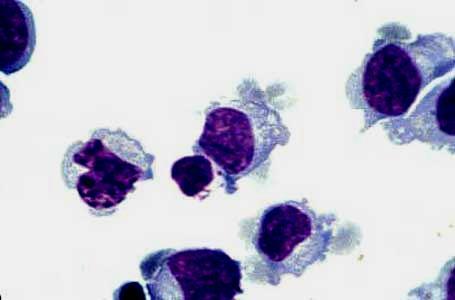 Komórki NK, NKT, limfocyty B-1, limfocyty T gd Komórki NK wykazuja aktywność
