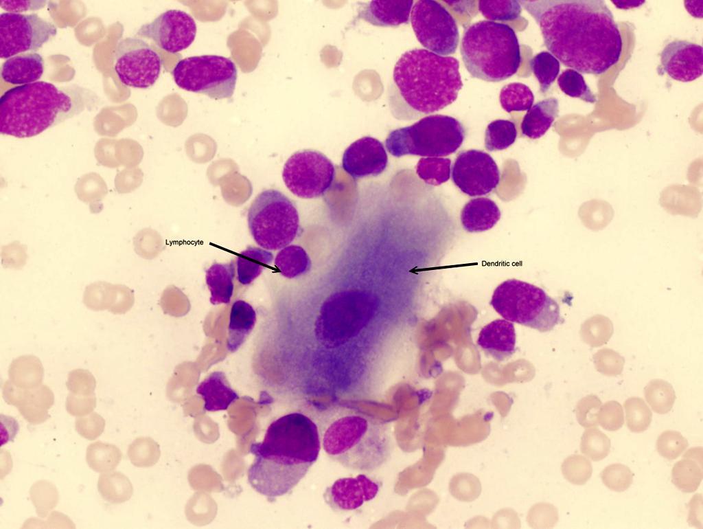 Komórki dendrytyczne Komórki dendrytyczne charakteryzuje zdolność do endocytozy i prezentacji antygenu.