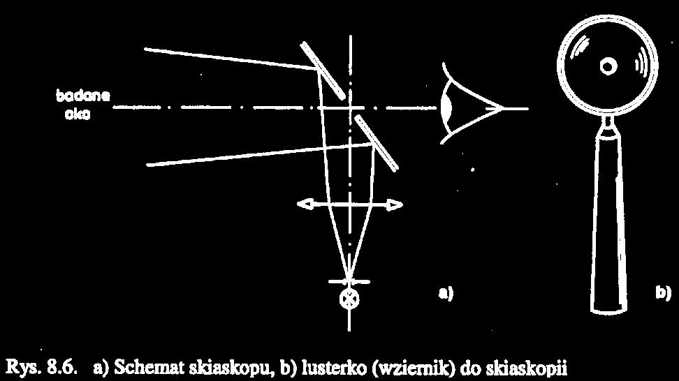 Schemat ogólny skiaskopu Wprowadzona w 1873 roku przez Fernanda Cuigneta. Zwana także retinoskopią. Użyteczna np.