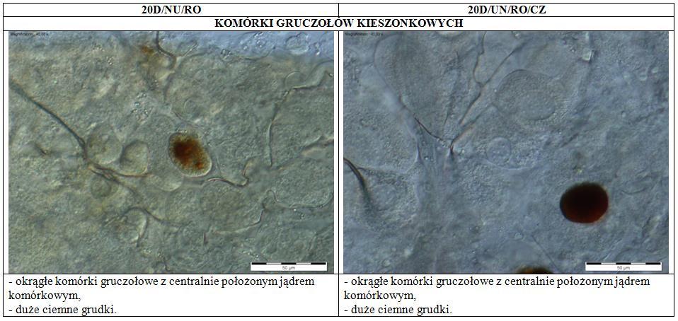 5.2.3 Obraz morfologiczny komórek gruczołów kieszonkowych i ich aktywność metaboliczna Obraz morfologiczny komórek gruczołów kieszonkowych Obraz morfologiczny komórek gruczołów kieszonkowych nie