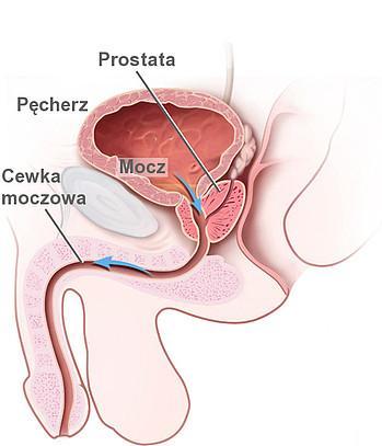 Stercz (gruczoł krokowy, prostata) Stercz leży w jamie miednicy ku przodowi od odbytnicy, za spojeniem łonowym, otaczając pierwszy odcinek cewki moczowej.