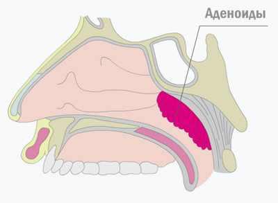 Jama nosowo-gardłowa Nosowa część gardła znajduje się z tyłu nosa, ponad poziomem podniebienia miękkiego.