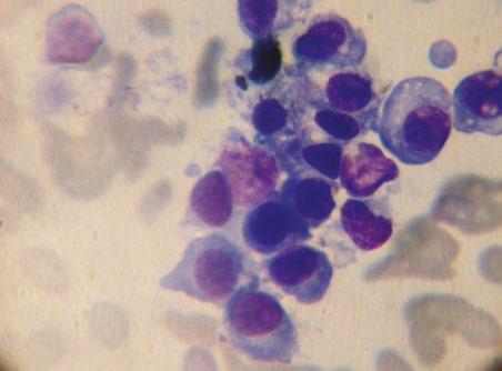 Mycoplasma felis limfocyt odczynowy z pofałdowanym jadrem
