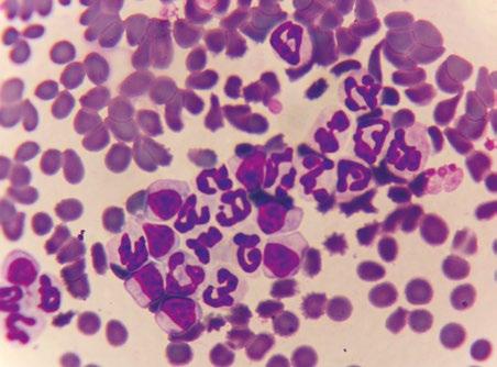 21 Mycoplasma felis AIHA (hemoliza wewnątrznaczyniowa z