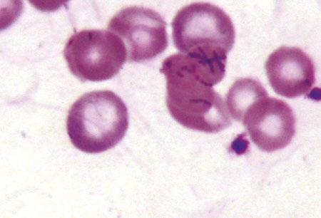 Fagocytoza we krwi obwodowej (obserwacje własne) Niszczenie krwinek czerwonych zawierających pasożyty, opłaszczonych przeciwciałami, neutrofili z morulami a także płytek krwi, w ww.