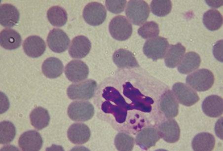 Can Vet J. 2009 August; 50(8): 835-840. 6. Gaunt S. at all. Experimental infection and co- -infection of dog with Anaplasma platys and Ehrlichia canis:hematologic, serologic and molecular findings.