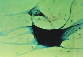 Wyraźnie barwią się wewnątrzneuronalne neurofibryle i stanowiące tło wypustki neuronalne (neuropil).