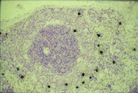 Barwienie histochemiczne na acetylocholinesterazę (AChE) wykazujące obecność tego enzymu, który przekształca