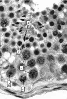 spermatocyty I rzędu: największe, często widoczne