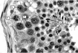 rzędu spermatydy Spermiogeneza: spermatocyty I rzędu