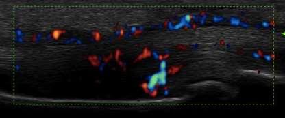 Curr Opinion Rheumatol