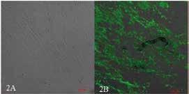 Rys. 4.4.2. Różnicowanie komórek hmsc, zdjęcia wykonane po 28 dniach hodowli. A) komórki hmsc próbka kontrolna; B) komórki hmsc po zróżnicowaniu w osteoblasty.