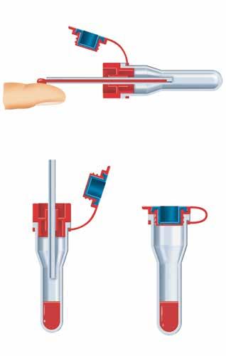 MIKROMETODA System pobierania krwi włośniczkowej z korkiem z przebijalną gumową membraną Probówka posiada wbudowaną w korek gumową membranę nadającą się do przekłuwania przez igły analizatorów