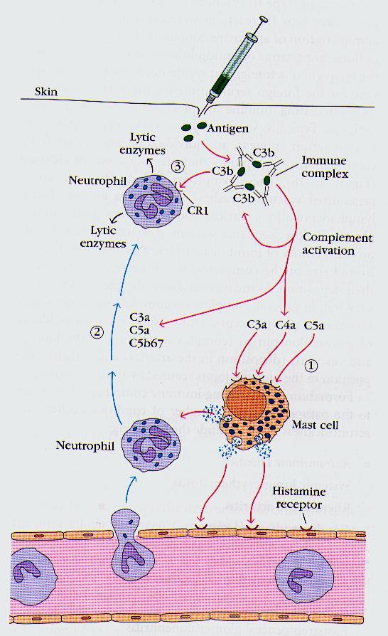 Typ III nadwrażliwości reakcja Arthusa (reakcja na antygeny bakteryjne, grzybicze,