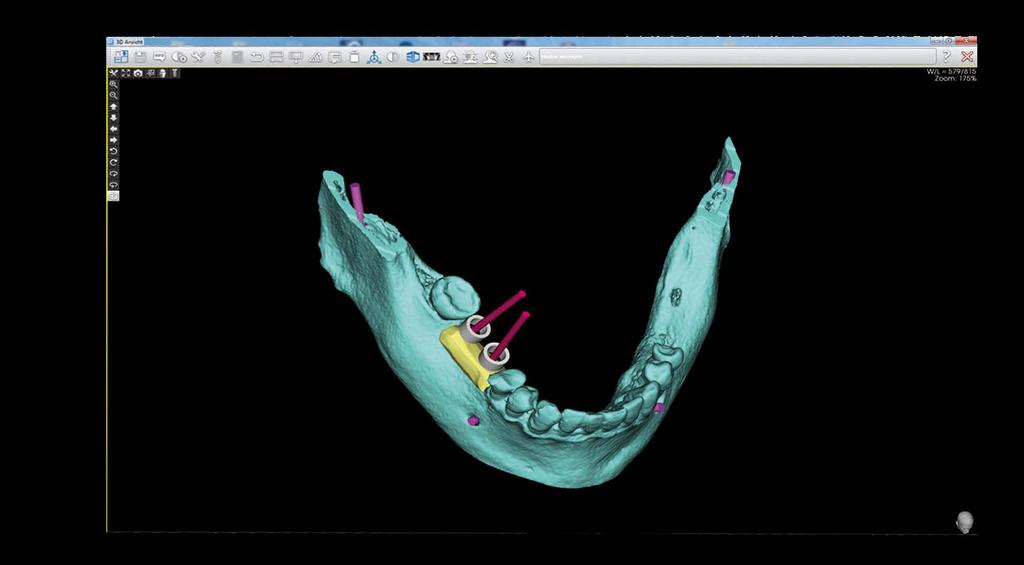 Imaging Software 3D ma wiele narzędzi pomiarowych, dzięki którym