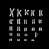 Chromosomy w pierwszym zestwie mją swoje odpowiedniki w drugim zestwie. Odpowidjące sobie chromosomy nzywmy chromosommi homologicznymi.