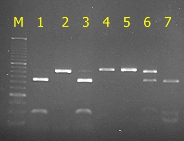 1) trawiono enzymem restrykcyjnym HinfI i otrzymano trzy wzory prążkowe odpowiadające genotypom AA, BB i AB, o długościach: 326 pz, 100 pz, 27 pz dla