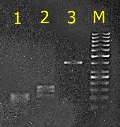 Otrzymany produkt PCR trawiono enzymem restrykcyjnym HaeIII i otrzymano trzy wzory prążkowe odpowiadające genotypom AA, BB i AB, o