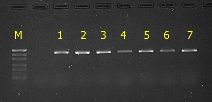 4.2.3. Polimorfizm genu hormonu wzrostu Fot. 5. Rozdział elektroforetyczny produktu PCR dla genu hormonu wzrostu.