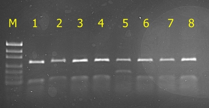 5) o długości 428 pz trawiono enzymem restrykcyjnym AluI i otrzymano trzy wzory prążkowe odpowiadające genotypom LL, VV i LV, o