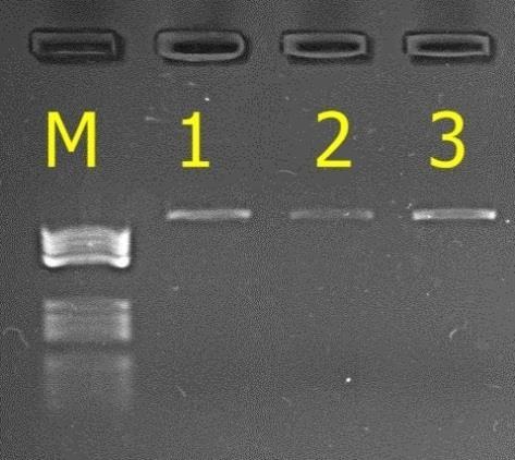 4.2.4. Polimorfizm genu prolaktyny Dodatkowo zbadano stado utrzymywane alkierzowo pod kątem polimorfizmu genu prolaktyny. Większość publikowanych badań opiera się na enzymie restrykcyjnym RsaI.