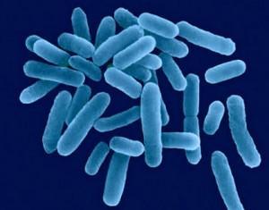 Legionella sp. Cechy charakterystyczne Występuje w wodach śródlądowych, morskich, w glebie i gorących źródłach wody.