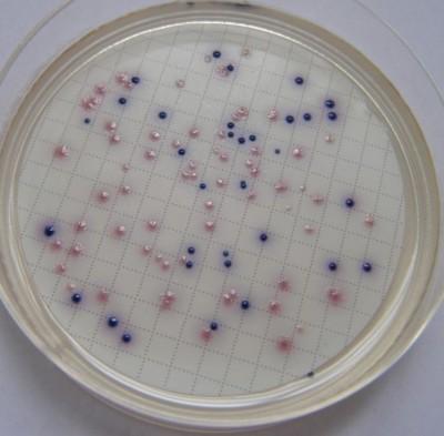 Wzrost oznaczanych mikroorganizmów na podłożach Wzrost Escherichia
