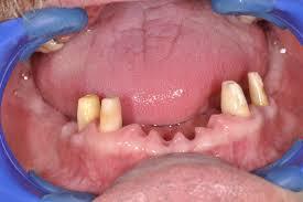 Etiopatogeneza NGS rak