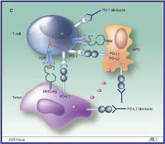 Keytruda is already approved for melanoma and non-small cell lung cancer.