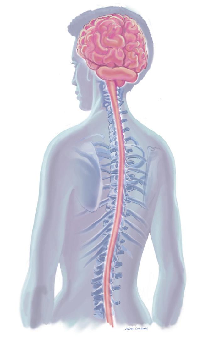 Stwardnienie rozsiane krótki opis W stwardnieniu rozsianym (SM) występuje stan zapalny, który zakłóca przewodzenie sygnałów elektrycznych pomiędzy komórkami nerwowymi w ośrodkowym układzie nerwowym.