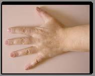 Ocena obciążenia mięśni kończyny górnej podczas użytkowania rękawic ochronnych.