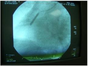 obróbce mogą być dobrym przybliżeniem wymaganego sygnału EKG (pomiar elektrycznej
