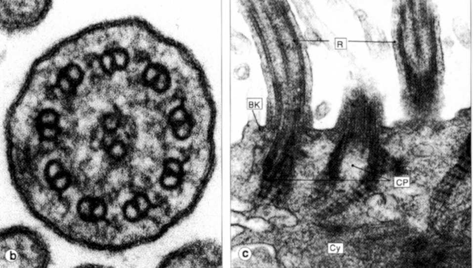 aksonemie: neksyna 9 obwodowych dubletów 2 mikrotubule centralne