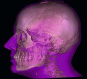 Planmeca Romexis Nowa wizja obrazowania 3D Nasze pionierskie oprogramowanie Planmeca Romexis oferuje specjalistyczne narzędzia dla implantologów, endodontów, periodontologów, protetyków, ortodontów,