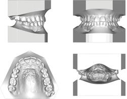 Planmeca Romexis Narzędzia 3D dla ortodo ntów i laboratoriów dentystycznych Moduł Planmeca Romexis 3D Ortho Studio to zestaw innowacyjnych narzędzi dla ortodontów i laboratoriów dentystycznych.