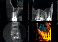 chcieliśmy samodzielnie uzyskiwać obrazy CBCT i zapewnić naszym pacjentom rentgen 3D na miejscu.
