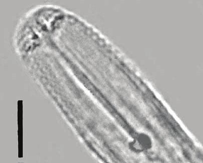 millefolii przy trawieniu enzymem AluI na wysokości ~1012 pz, a przy trawieniu enzymem HinfI na wysokości ~888 pz (rys. 4).