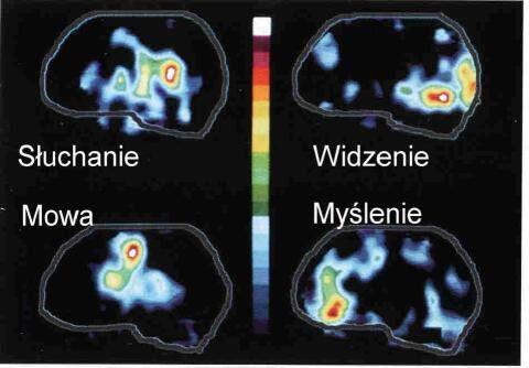 Aktywność poszczególnych obszarów mózgu w