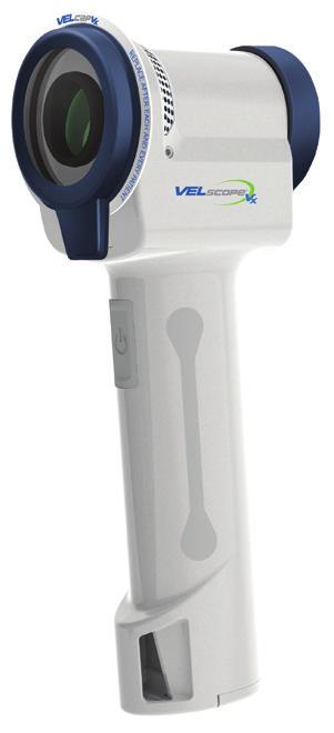 Czym jest VELscope Vx? VELscope Vx, jako najnowszy model z LED Dental's VELscope technology, wykorzystuje fluorescencję naturalnych tkanek do wykrywania nieprawidłowości w błonie śluzowej jamy ustnej.