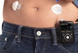 Insulina + sprzęt do jej podawania + sprzęt do monitorowania glikemii