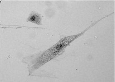 tk. łącznej Pochodzenie: z komórek mezenchymatycznych (fibroblasty, telocyty