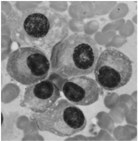 siateczka szorstka aparat Golgiego egzocytoza konstytutywna Pochodzenie: limfocyty B Komórki tuczne (mastocyty), po