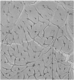 podstawową najliczniejsze komórki spoczynkowe fibroblasty zwarty układ