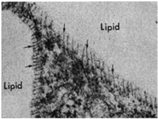 jednopęcherzykowy: duży (do 100 μm) pojedyncza wielka kropla lipidowa