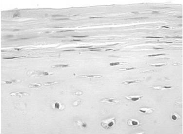 chrząstka stawowa: brak ochrzęstnej macierz torebkowa macierz